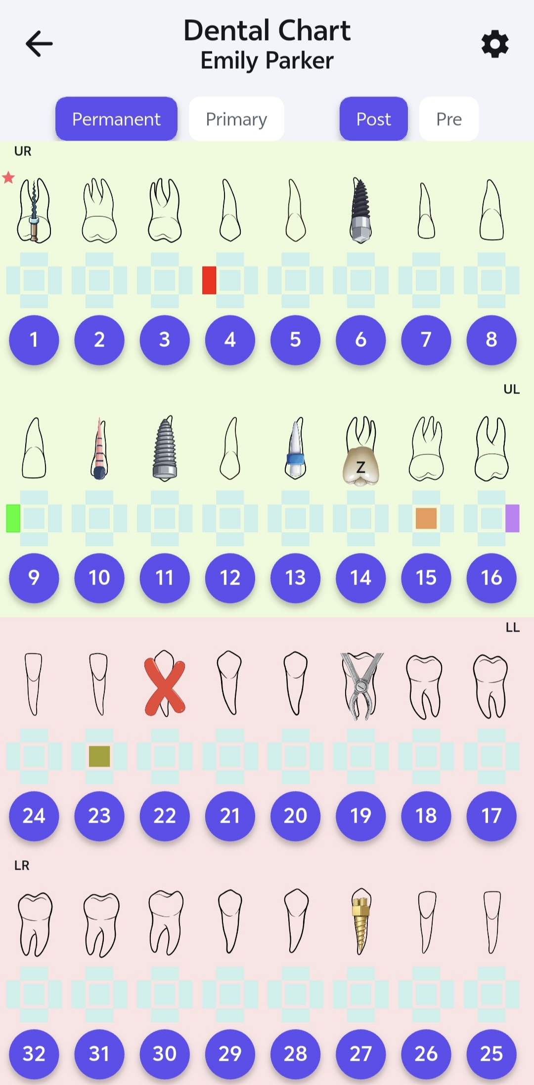 dental chart