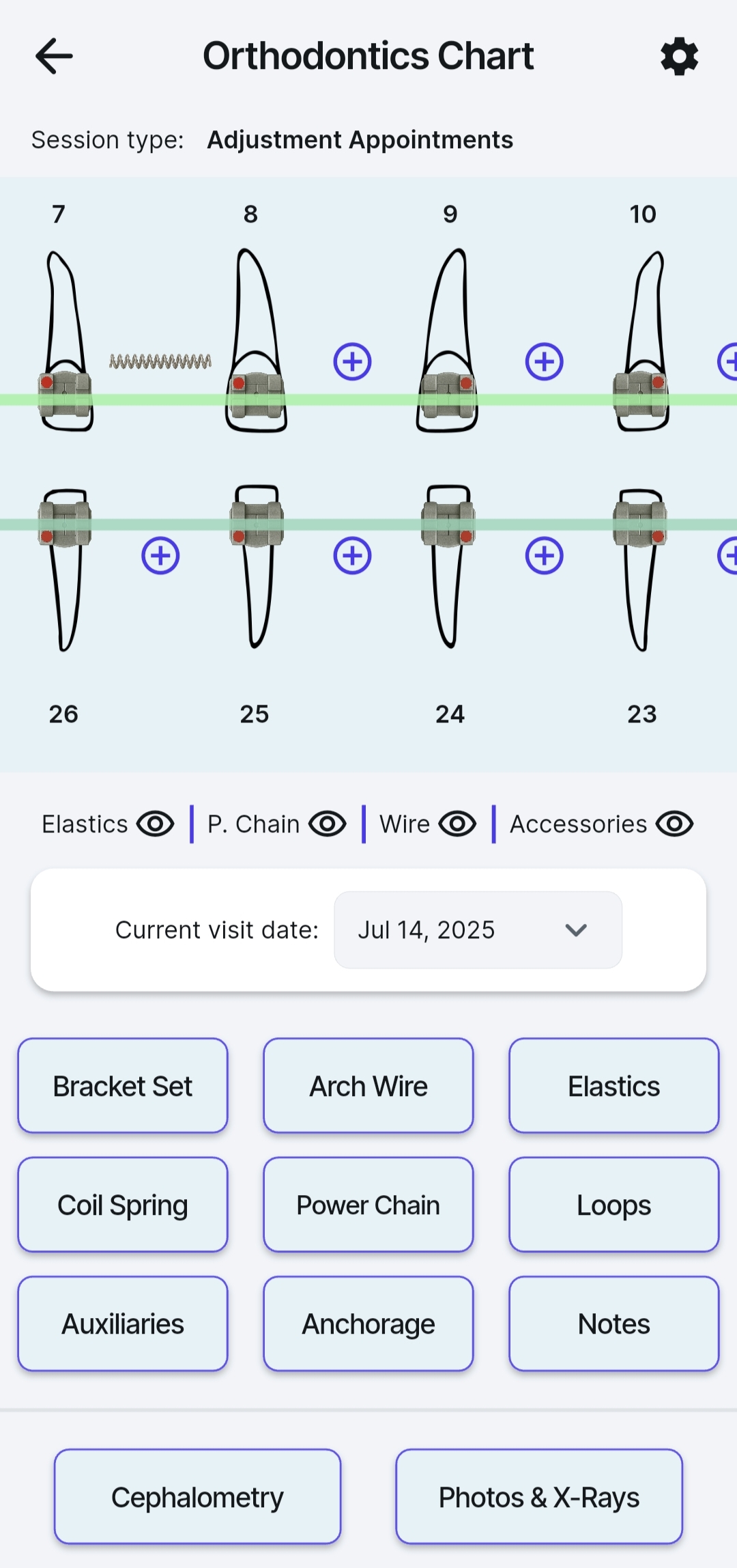 orthodontics chart