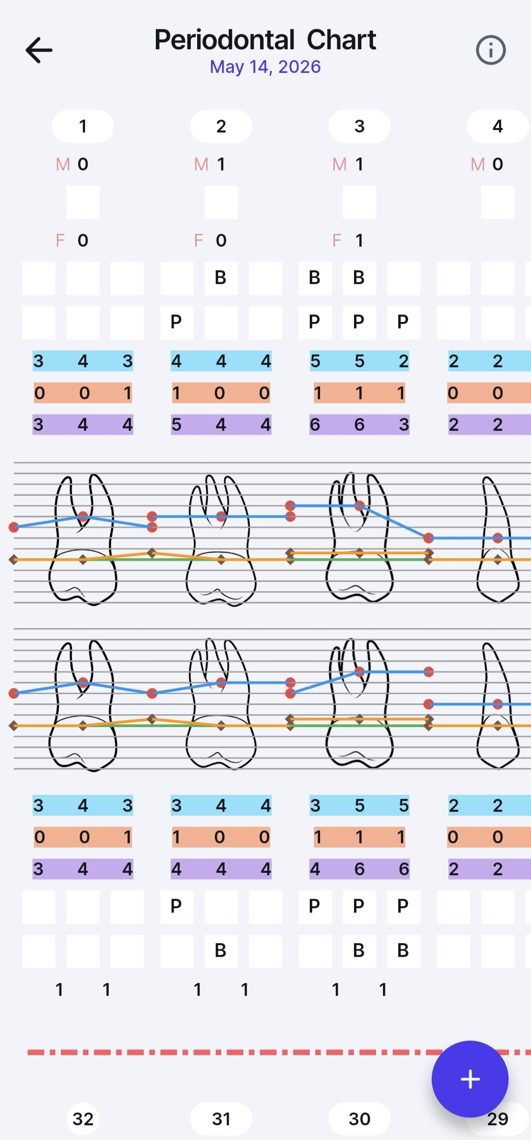 perio chart (1)